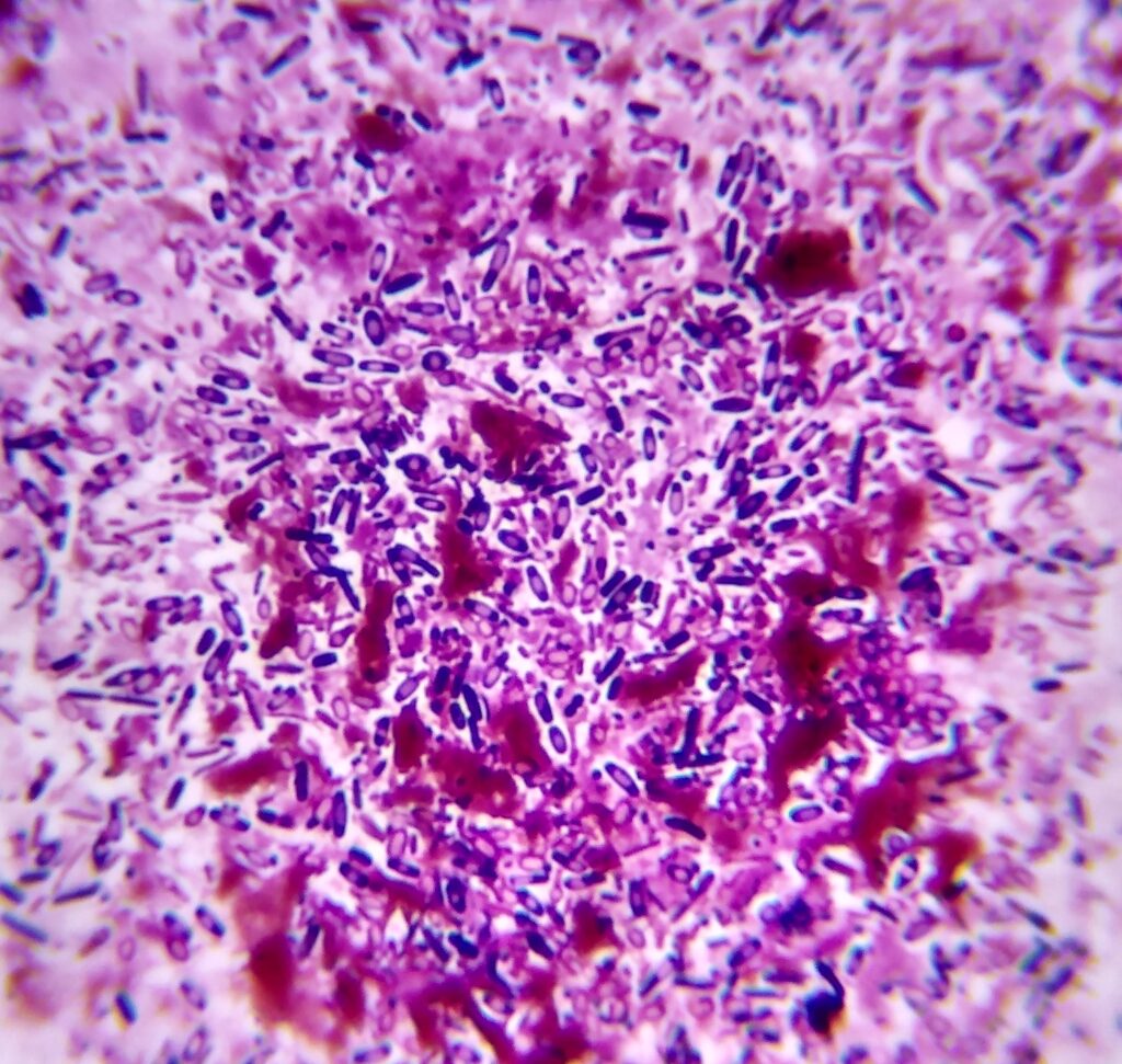 Microbiología y Cultivo