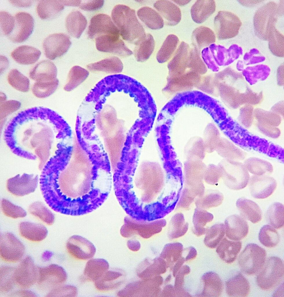 Hematología