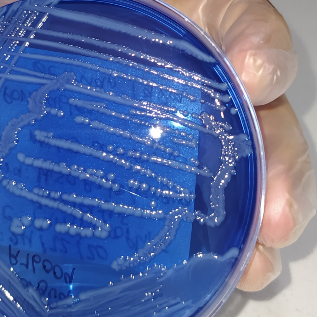 Microbiología y Cultivo